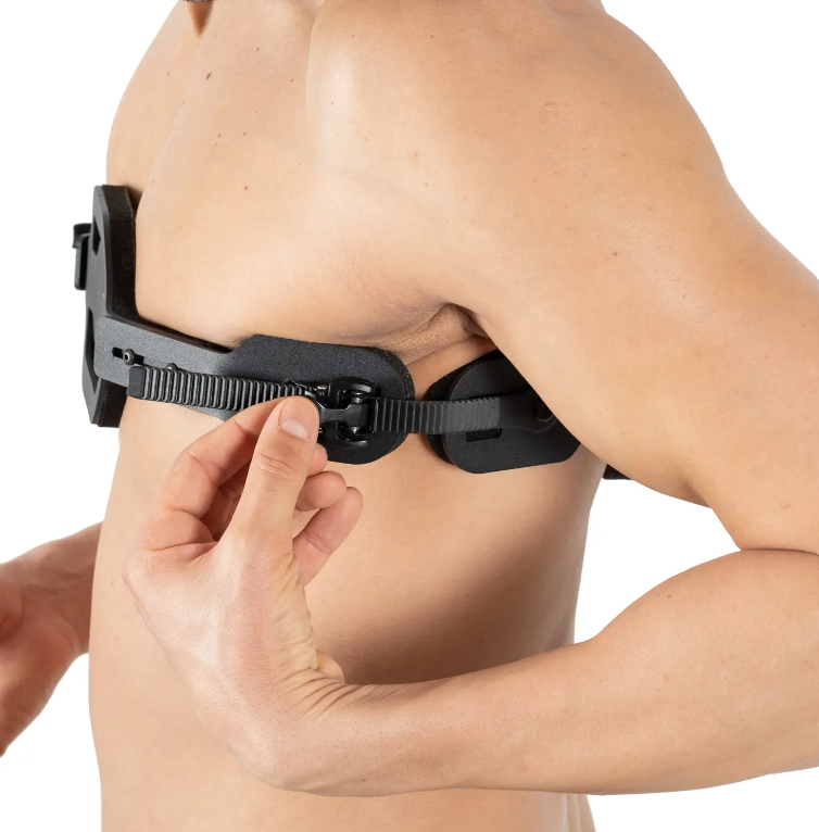 Pectus Carinatum Orthosis || تقويم الصدر الجؤجؤي - Image 3